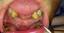 The real dental problems The real dental problems