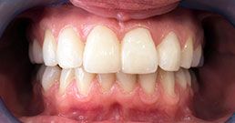 Hollywood smile dental Hollywood smile dental
