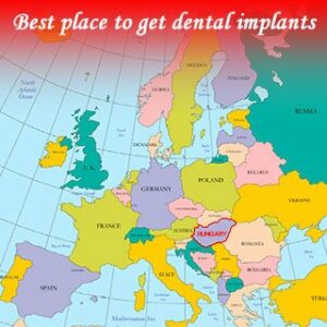 Best place to get dental implants