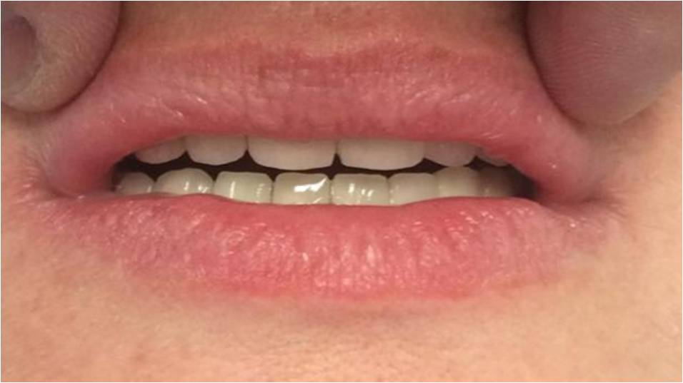 dentist recommendations