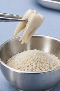 the extracted tooth is processed granules using