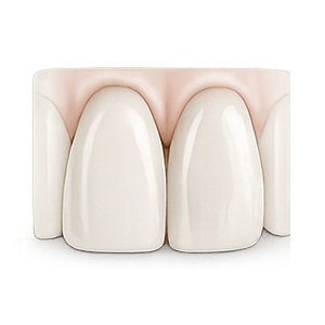 Veneers Icon